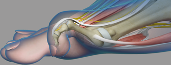 Common Toe Deformities