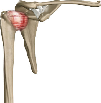 Frozen Shoulder